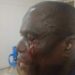 Kwara United Apologize, Condemns Fan Violence At Rivers United Match