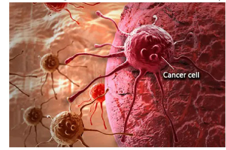 Tackling Nigeria’s Cancer Crisis Through Prevention, Equity 1 cancer cell