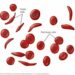 Is The Quest to Cure Sickle Cell in Nigeria Finally Yielding Results?
