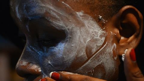 skin Bleaching