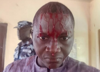 MRA Demands Probe After Police Assault Journalist In Bauchi