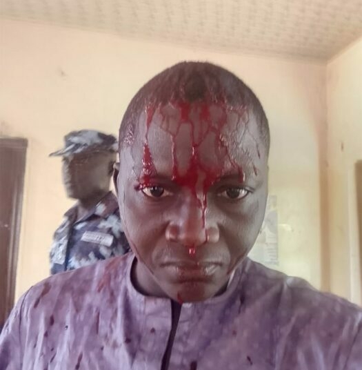 MRA Demands Probe After Police Assault Journalist In Bauchi 1 Assualt