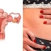 Gynaecologist Warns Uncontrolled Conditions Raise Fibroid Surgery Risks 5 Gynaecologist Warns Uncontrolled Conditions Raise Fibroid Surgery Risks