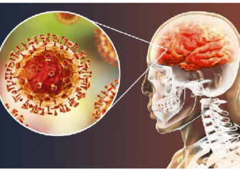 Nigeria’s Meningitis Burden Persists As Dry Season Fuels Outbreaks