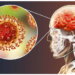 Nigeria’s Meningitis Burden Persists As Dry Season Fuels Outbreaks