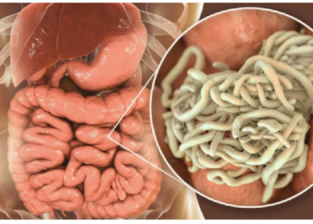 How Intestinal Worms Are Harming Nigeria’s Children