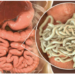 How Intestinal Worms Are Harming Nigeria’s Children
