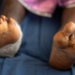NGO Empowers Leprosy-affected Persons In Plateau 5 Niger Leprosy Patients Receive Electronic Materials To Ease Treatment