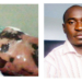 HOW I OVERCAME: Against All Odds, I Survived 65% First Degree Burns – Auta 5 HOW I OVERCAME: Against All Odds, I Survived 65% First Degree Burns – Auta