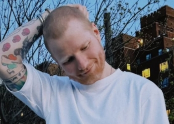 Ed Sheeran Shaves Hair, Opens Up About Shingles Battle And ‘Fresh Start’