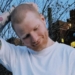 Ed Sheeran Shaves Hair, Opens Up About Shingles Battle And ‘Fresh Start’