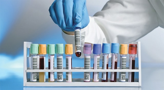 Lab Practitioners Decry Poor Sachet Water Regulation 1 laboratory