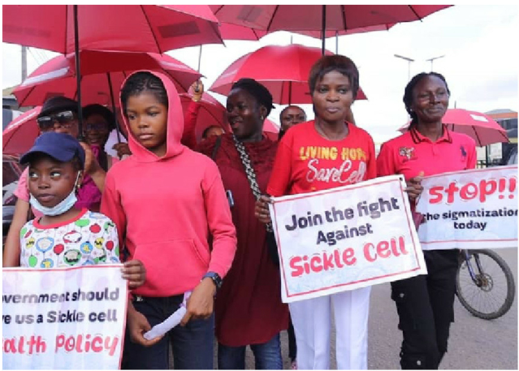 sickle cell