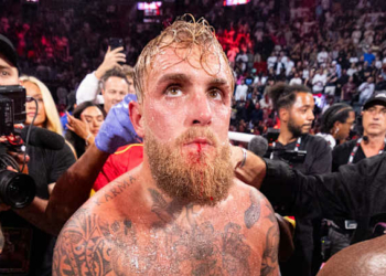 Paul Casts Doubt On Boxing Career After Jaw Injury