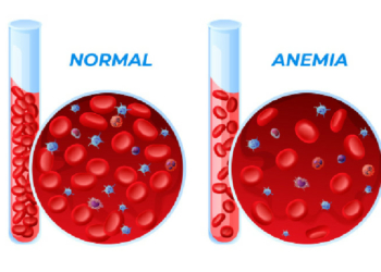 Preventing Maternal Anaemia For Healthier Mothers, Babies