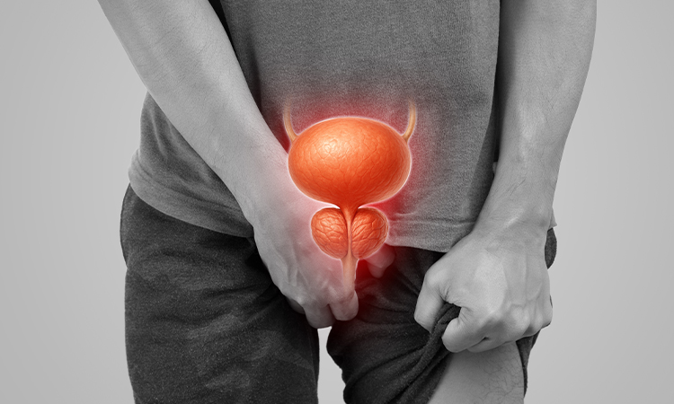 Prostate Cancer Risks Remain High For African Men, Expert Warns