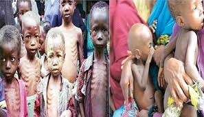 Malnutrition :342,919 Children Under 2 In Benue Are Stunted-- Expert 1 images 2026 05 07T104305.202