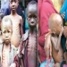 Malnutrition :342,919 Children Under 2 In Benue Are Stunted– Expert