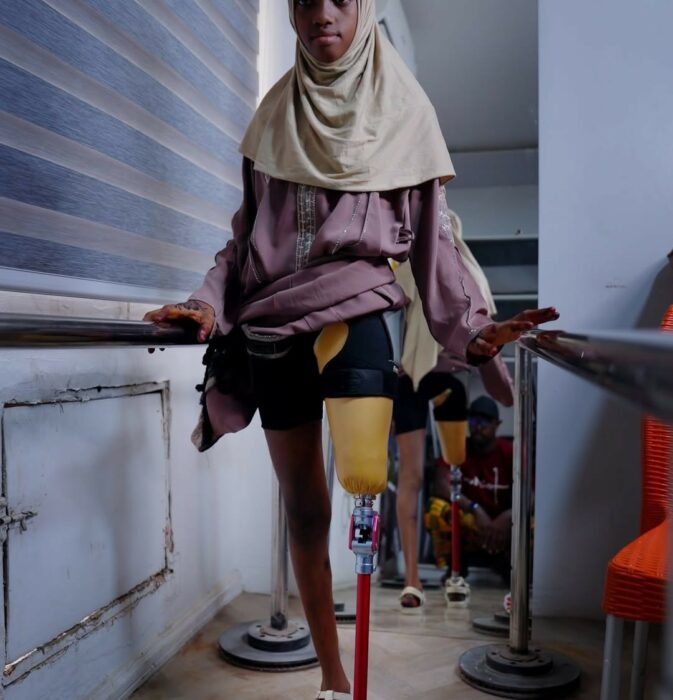 Cardtonic Cares And Irede Foundation Help Hassana Walk Again