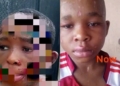 Fresh Photo Of Abused Anambra Boy Sparks Fresh Outrage Online