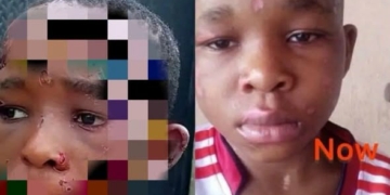 Fresh Photo Of Abused Anambra Boy Sparks Fresh Outrage Online