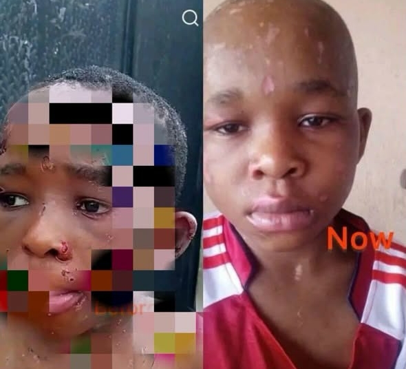 Fresh Photo Of Abused Anambra Boy Sparks Fresh Outrage Online 1 Child abuse