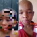 Fresh Photo Of Abused Anambra Boy Sparks Fresh Outrage Online