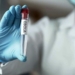 Central Africa's Ebola Cases Rise To Nearly 500 5 US Warns New Ebola Outbreak Could Match Deadliest 2014 Scale