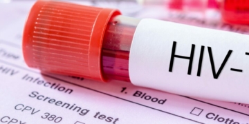 UN Says Decline In External Financing Expanding HIV Cases In Africa, Others 2 UN Says Decline In External Financing Expanding HIV Cases In Africa, Others