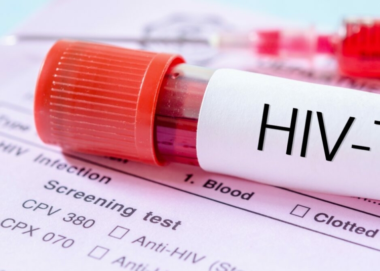 HIV test label on HIV infection screening test form.