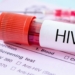 UN Says Decline In External Financing Expanding HIV Cases In Africa, Others
