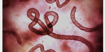 Uganda’s Health Minister Declares Country Free Of Ebola