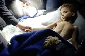 Venezuela Earthquake: 3-Year-Old Rescued Alive After 6 Days 