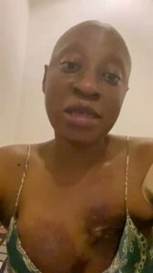 Nollywood Actress Cynthia Anijekwu Appeals for Public Support for Cancer Treatment