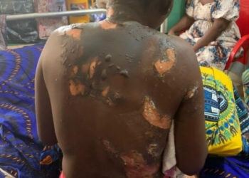 Man Arrested For Allegedly Setting Wife Ablaze In Kogi