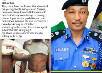 FCT Police Debunks Viral Claim Of Kidney Sales In Nyanya