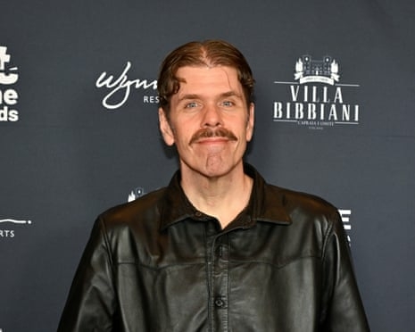 Perez Hilton Hospitalised After Disturbing TikTok Livestream Sparks Welfare Response 1 IMG 4364