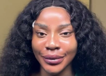 “I Don’t Like How I Look” — Uche Ogbodo Reacts To Facial Transformation After Cosmetic Procedure