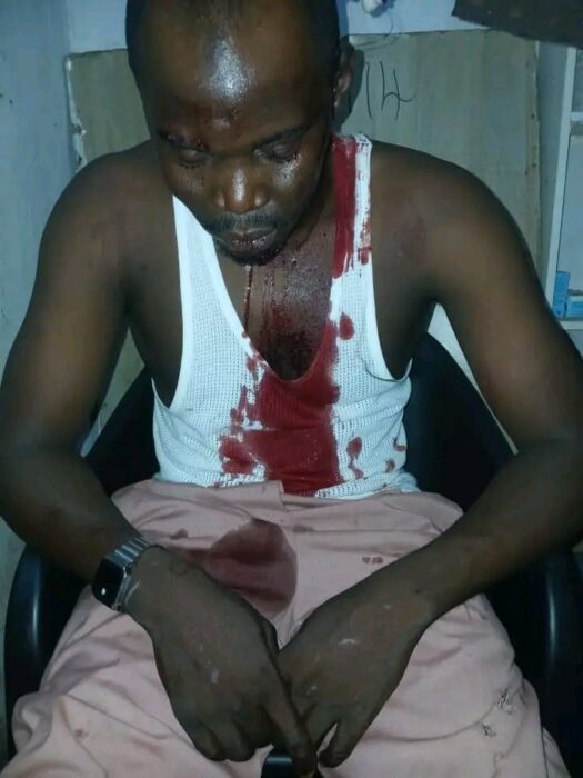 APC Demands Probe Of Reported Attacks On Offices, Vehicles In Kaduna