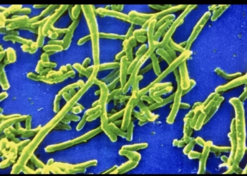 Microscopic view of Corynebacterium diphtheriae, the bacterium that causes diphtheria. Credit: CDC Public Health Image Library.