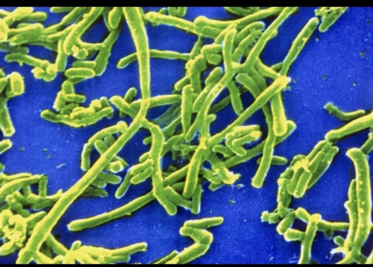 Diphtheria Outbreak: What Nigerians Need To Know As Cases, Deaths Rise (2) 1 Microscopic view of Corynebacterium diphtheriae, the bacterium that causes diphtheria. Credit: CDC Public Health Image Library.