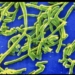 Diphtheria Outbreak: What Nigerians Need To Know As Cases, Deaths Rise (2) 5 Microscopic view of Corynebacterium diphtheriae, the bacterium that causes diphtheria. Credit: CDC Public Health Image Library.