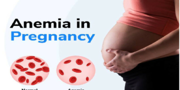 How MMS Stockouts Are Fuelling Nigeria’s Maternal Anaemia Burden