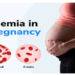 How MMS Stockouts Are Fuelling Nigeria’s Maternal Anaemia Burden 5 How MMS Stockouts Are Fuelling Nigeria’s Maternal Anaemia Burden