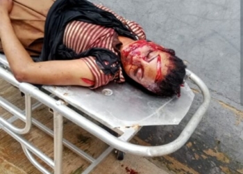 Meat Seller Hacks Wife To Death In Ekiti, Flees