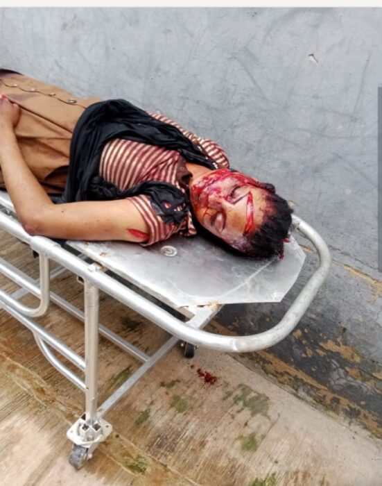 Meat Seller Hacks Wife To Death In Ekiti, Flees