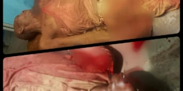   2 Suspected Area Boys Die In Fight Over Money Sharing In Ibadan