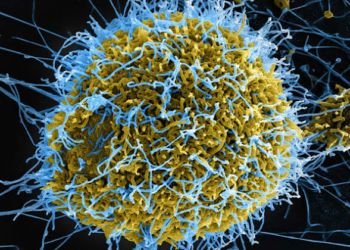 Ebola Patient’s Condition Worsens – NCDC