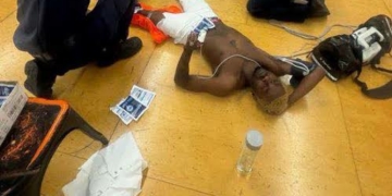 Omah Lay Hurts Self During Rehearsal, Rushed To US Hospital 4 Omah Lay Hurts Self During Rehearsal, Rushed To US Hospital