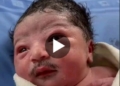 “Senior Man Baby”- Reactions As Baby Born With Full Blown Moustache Goes Viral